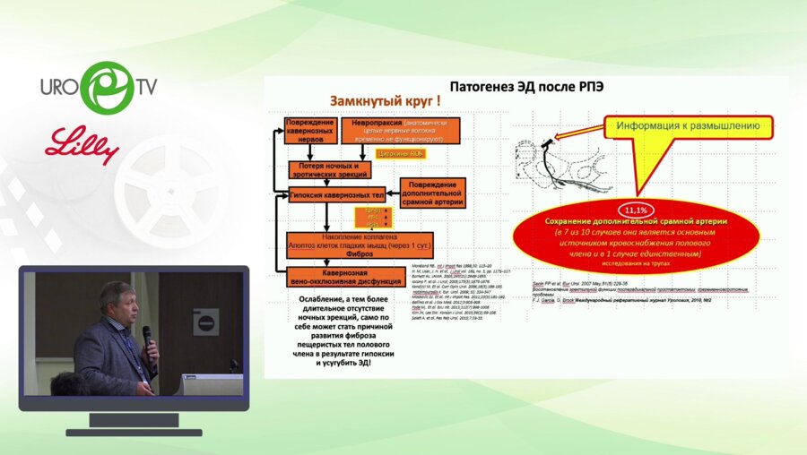 Новиков А.И. - Медикаментозная терапия эректильной дисфункции после радикальной простатэктомии