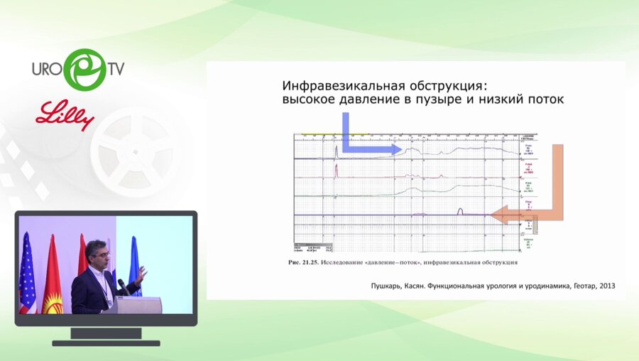 Касян Г.Р. - Послеоперационное применение а-блокаторов. Бренд и генерики