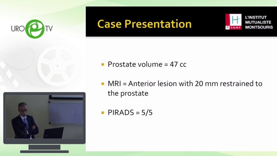 Eric Barret - Фокальная криоаблация. Focal Cryoablation