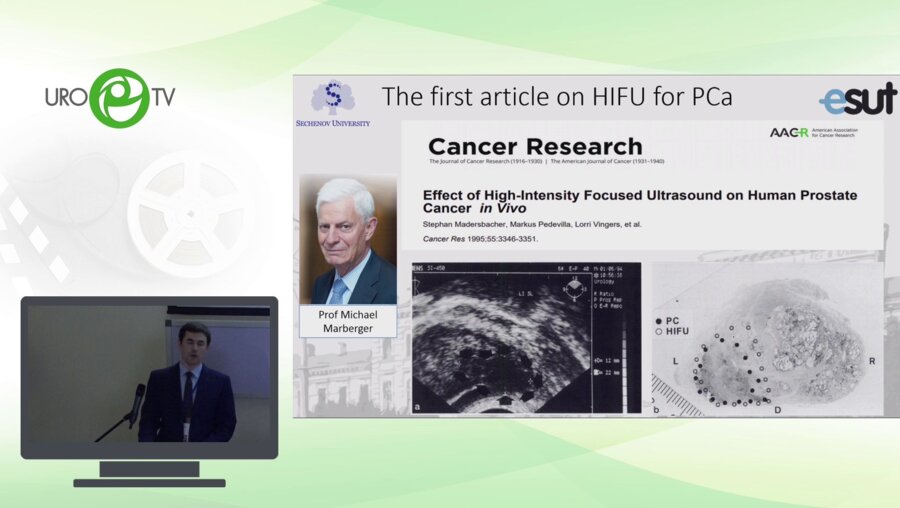 Ганжа Т.М. - Высокочастотная ультразвуковая аблация рака простаты. 15 лет опыта