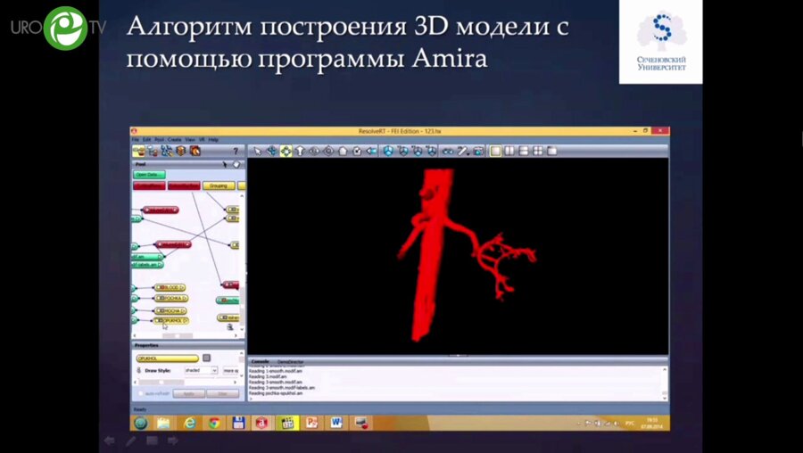 Шпоть Е.В. - Современные технологии в диагностике и лечении рака почки