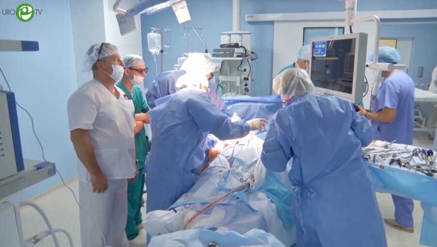 Носов А.К. - Лапароскопическая простатэктомия 3D