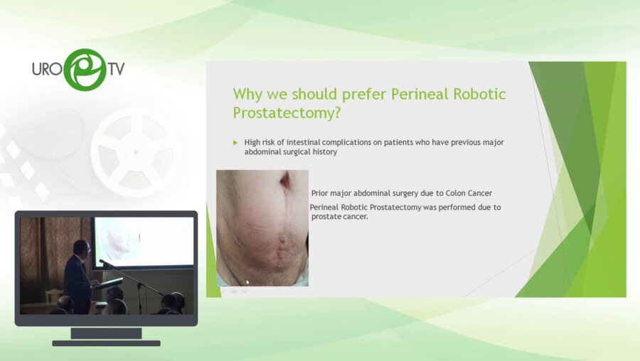 Волкан Тугчу - Промежностная РПЭ