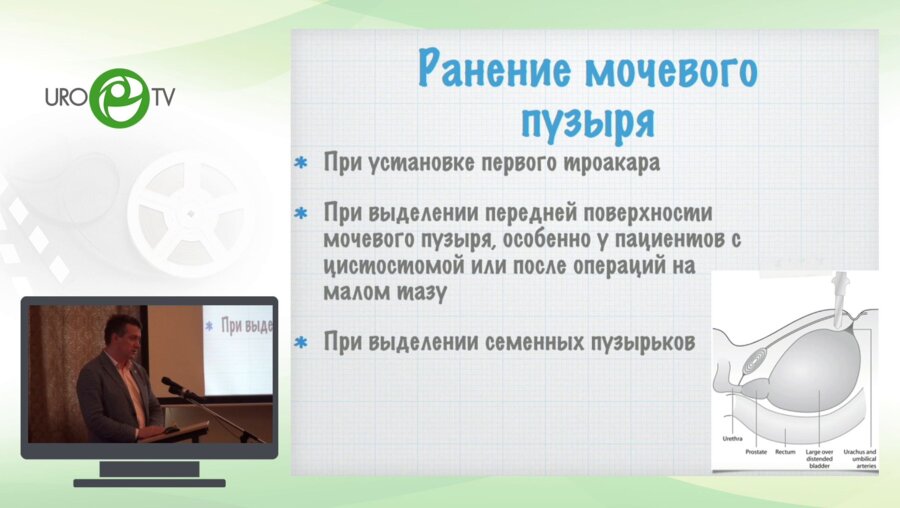 Орлов И.Н. - Осложнения, возникающие при ЭВХ ПЭ, и методы борьбы с ними