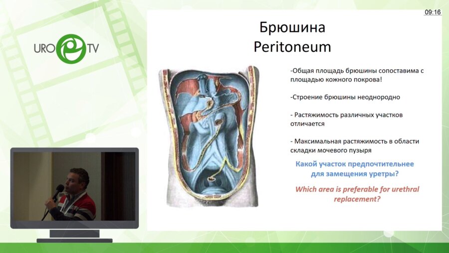 Григорьев В.Г. - Перитонеальный графт - первый опыт применения при аргументации протяженных стриктур уретры