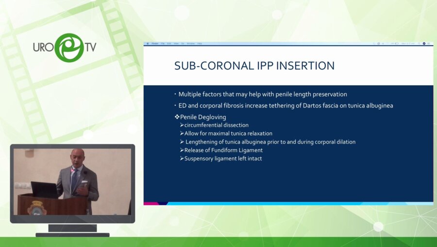 Валензуэла Р. - Оперативные доступы для фаллопротезирования: что нужно знать?