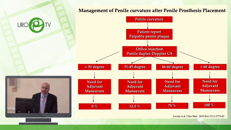Муннарис Р. - Преодоление сложных случаев и осложнений при фаллопротезировании