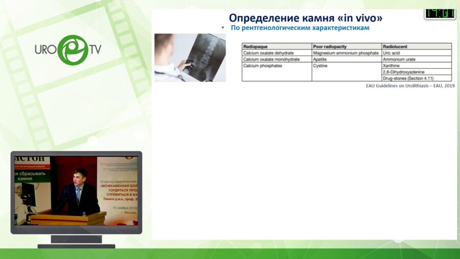 Войтко Д.А. – Определение химического состава мочевого камня «in vivo» на основе спектра потребляемых нутриентов