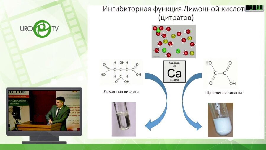 Просянников М.Ю. - Новые возможности коррекции гипероксалурии