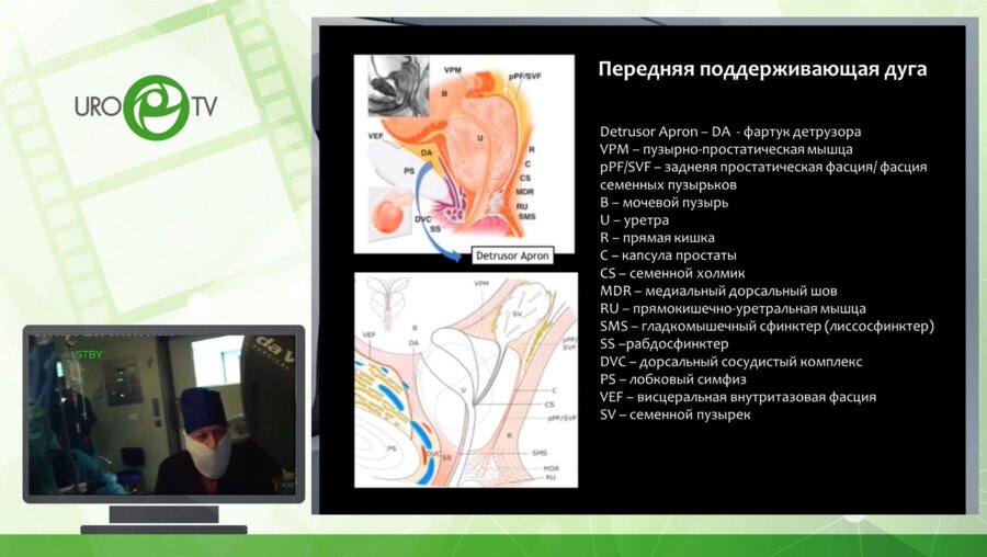 Абоян И.А. - Робот-ассистированная радикальная простотэктомия. Латериальный доступ