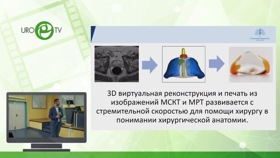 Слусаренко Р.И. - 3Д простаты для предоперационного планирования Робот-РПЭ. Миф или реальность