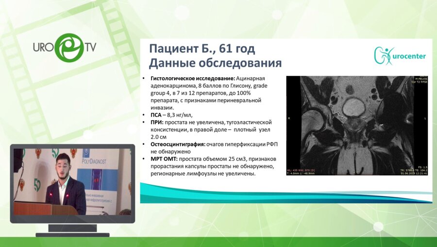 Кочкин А. Д. - Лапароскопическая радикальная простатэктомия