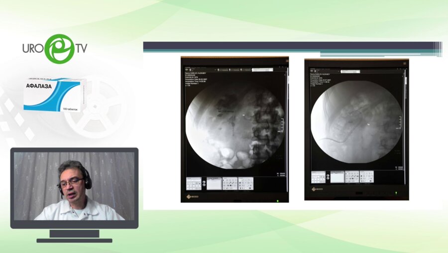 Лелюк В.Ю. - Воспалительные осложнения ДЛТ: избежать и не допустить?