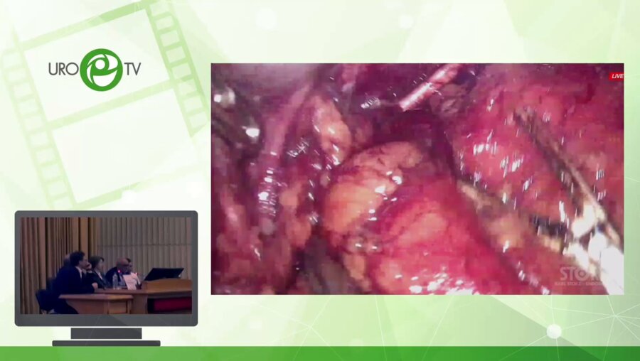 Операционная секция №2