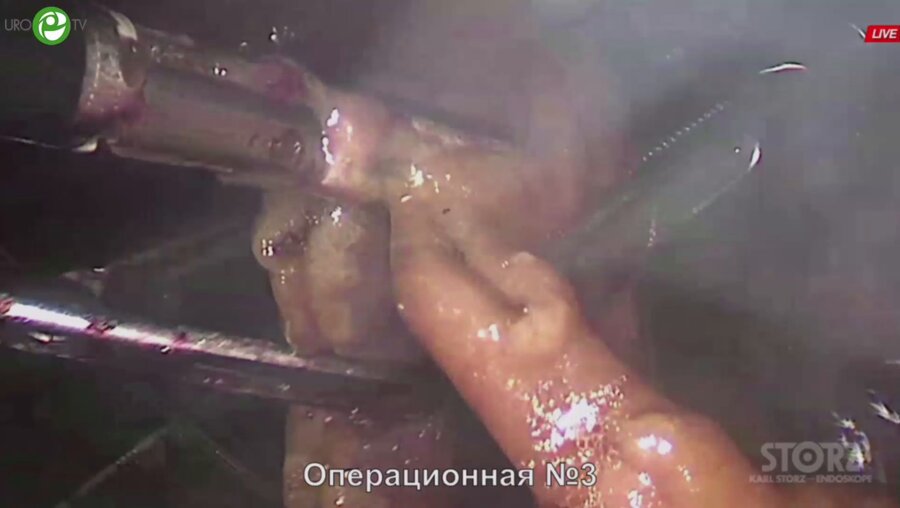 Операционная секция №4