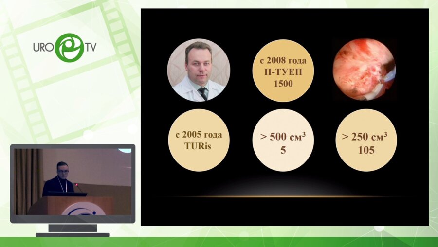 Кнутов А.В. - Лапароскопическая аденомэктомия в клинике профессора Ф.А. Севрюкова