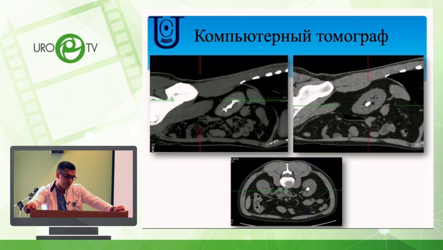 Сулейманов М.М. - Оборудование для хирургии МКБ