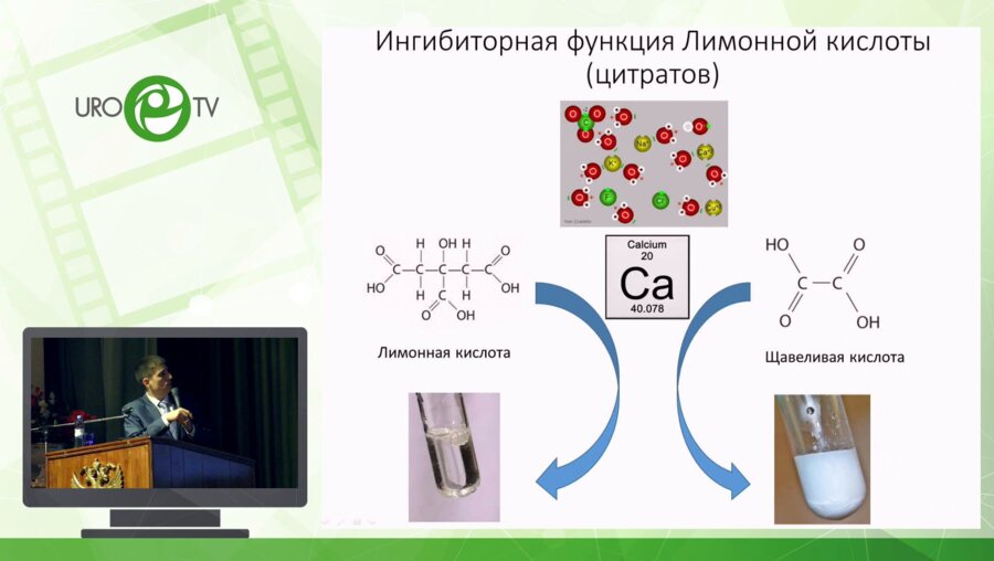 Просянников М.Ю. - Метафилактика мочекислого уролитиаза