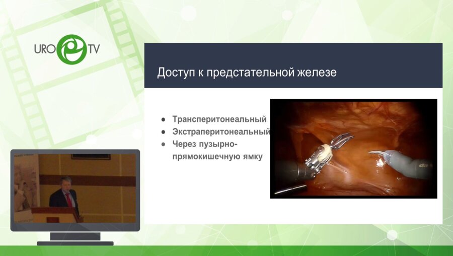 Нестеров С.Н. - Робот-ассистированная простатэктомия. Советы и рекомендации