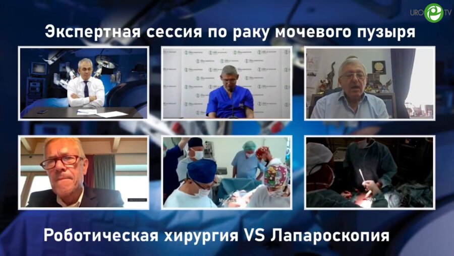 Экспертная сессия по раку мочевого пузыря «Роботическая хирургия VS Лапароскопия»