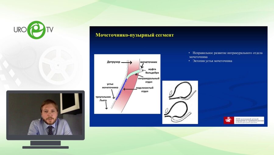 Демин Н.В. - Пневмовезикоскопические операции при патологии уретеровезикального соустья у детей