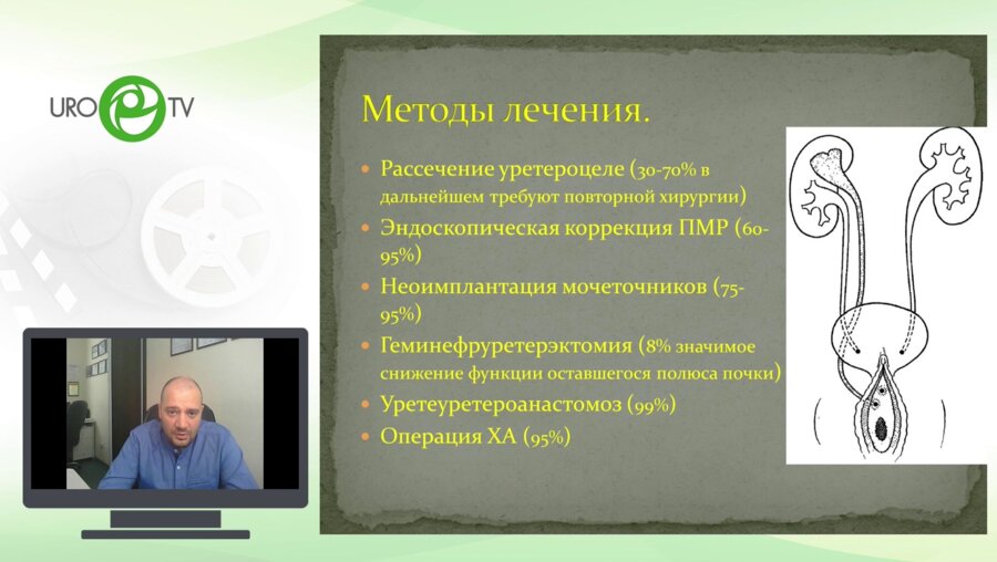Каганцов И.М. - Обструкция при удвоении почки. Чему отдать предпочтение