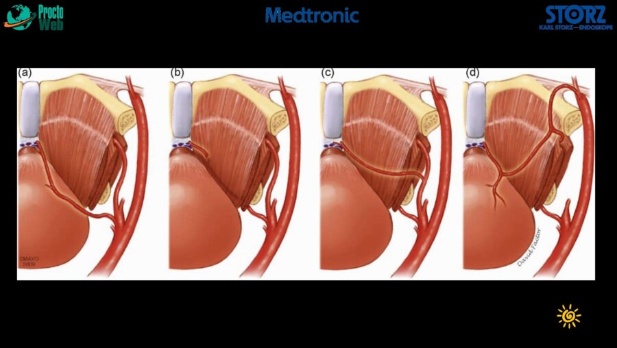 Кочкин А.Д. - Хирургическая анатомия простаты
