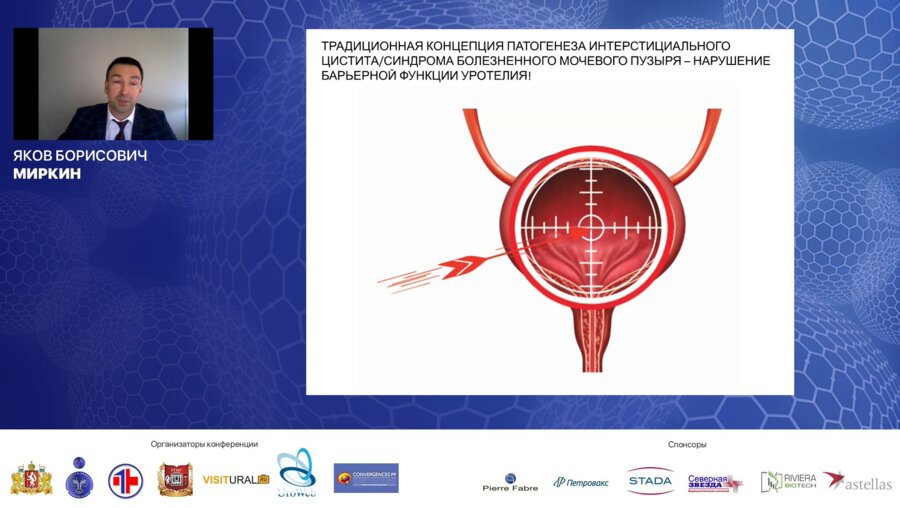 Миркин Я.Б. - Интерстициальный цистит или синдром болезненного мочевого пузыря