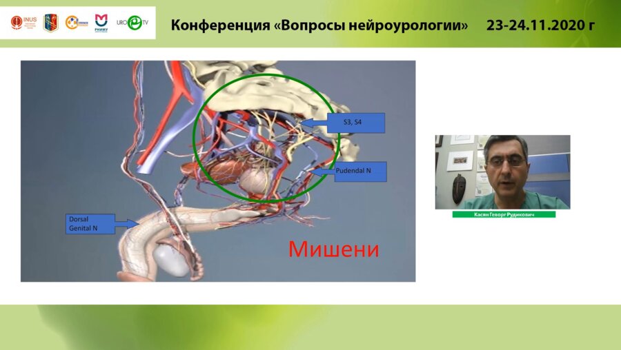 Касян Г.Р. - Сакральная нейромодуляция при идиопатических формах нарушения акта мочеиспускания