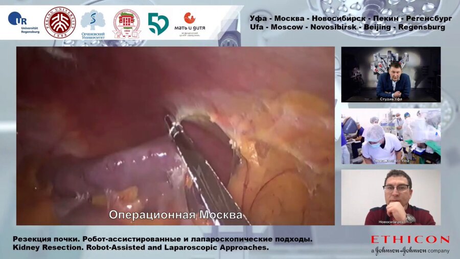 Э.А. Галлямов - Лапароскопическая резекция почки.