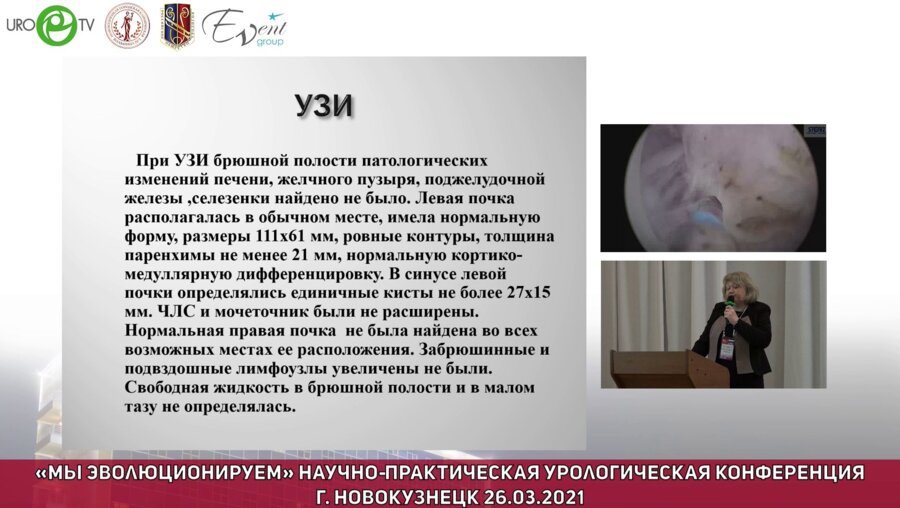 Кольтябина О.Н. - Редкий случай сочетания агенезии почки и эктопии яичника