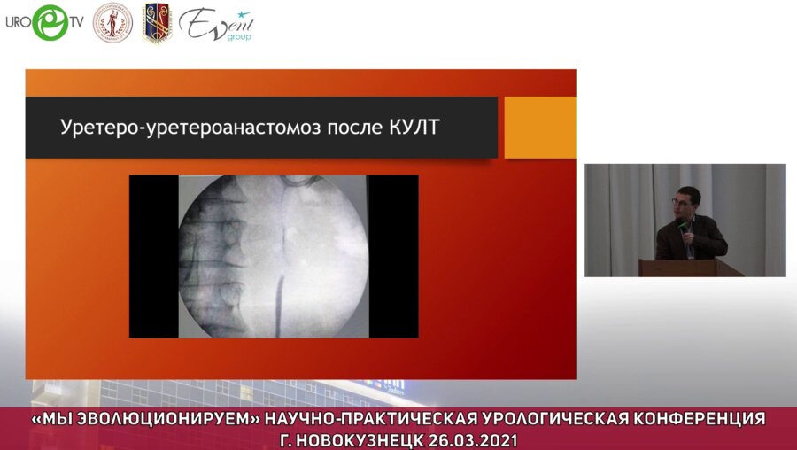 Холтобин Д.П. - Особенности лапароскопической пластики мочеточников