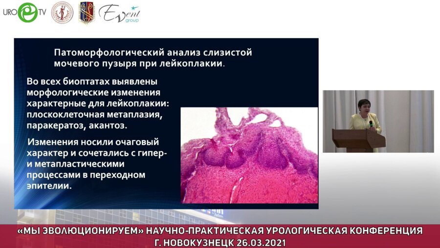 Ильинская Е.В. - Лейкоплакия мочевого пузыря. Новое о старом