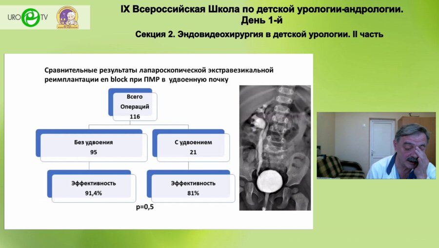 Бондаренко С.Г. - Лапароскопическая экстравезикальная реимплантация с одномоментным