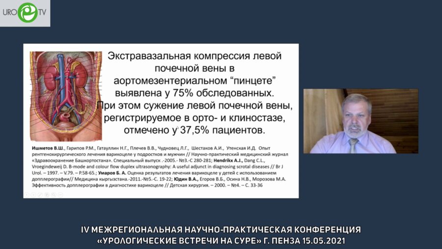 Крупин В.Н. - Варикоцеле. Новый взгляд на старую проблему