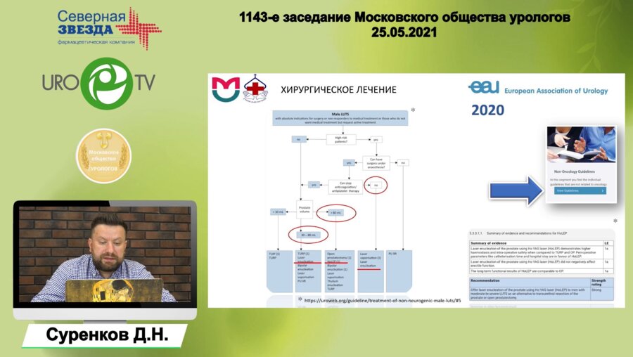 Суренков Д.Н. - HoLEP - Новый стандарт хирургического лечения ДГПЖ