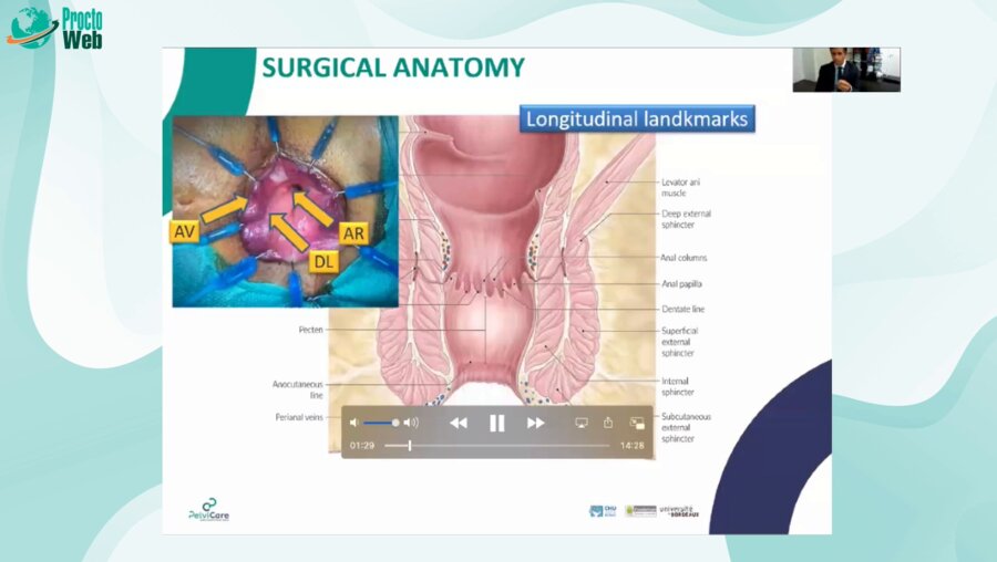 Quentin Denost - ISR and Anatomy of the Anal Canal