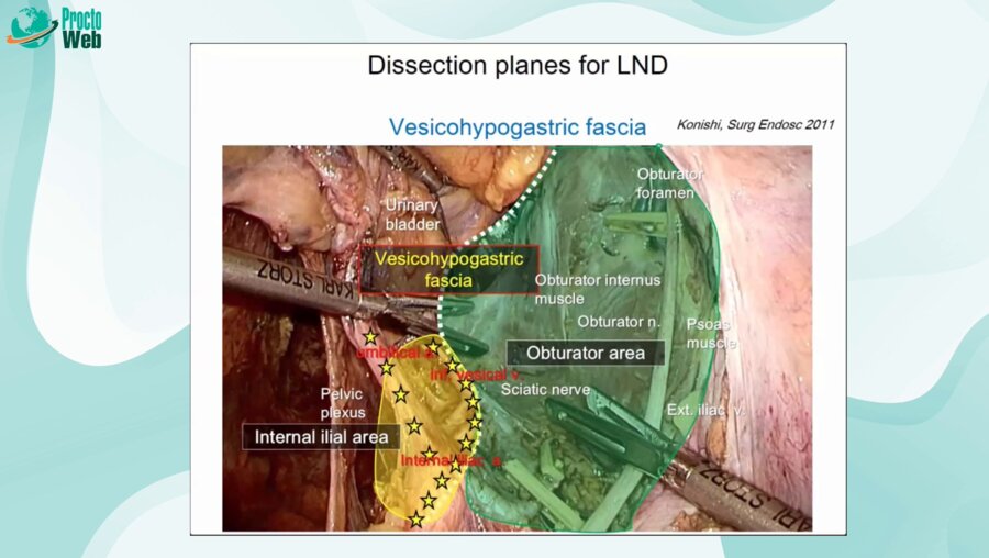 Tsuyoshi Konishi - Combined Resection of the Vessels, Nerves