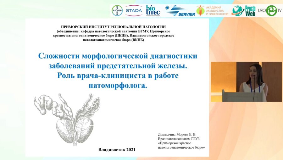 Морова Е.В. - Сложности морфологической диагностики заболеваний предстательной железы