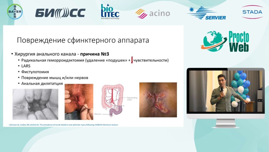 Маркарьян Д.Р. - Анальное недержание после родов. Масштаб проблемы и пути решения