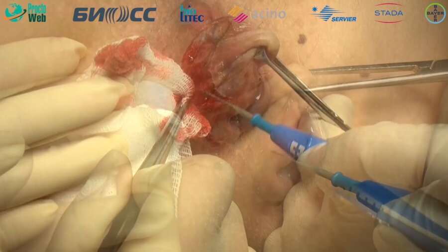 Маркарьян Д.Р.Видеосессия