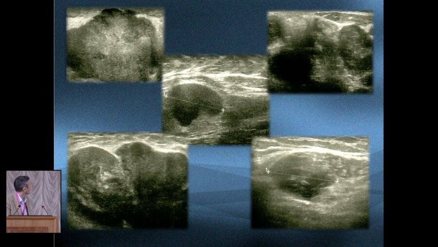 Широкий В.П. - Биопсия молочной железы в реальной практиче хирурга поликлиники