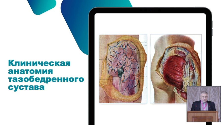 Жданов В.В. - Техника пункции тазобедреного сустава