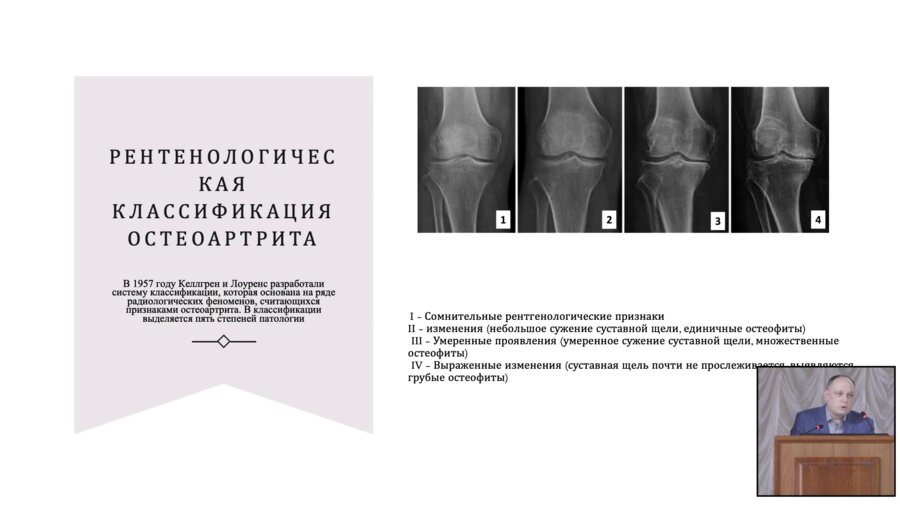 Лущенко С.В. - Применение комбинированных препаратов гиалуроновой кислоты в консервативном лечении остеоартрита