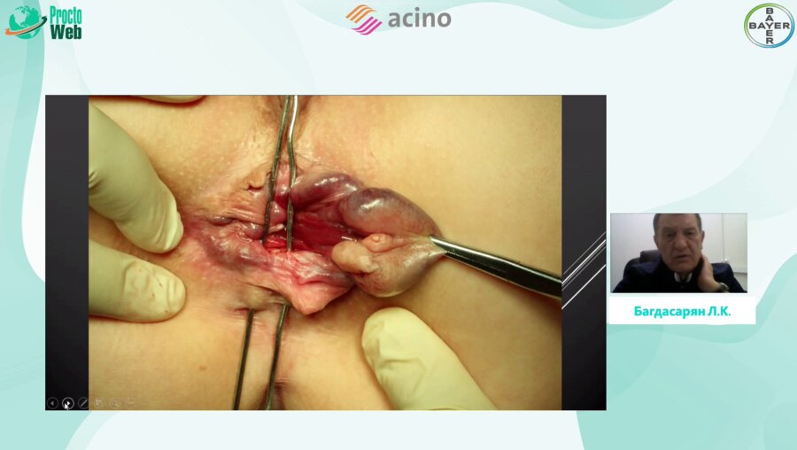 Багдасарян Л.К. - Клинические случаи