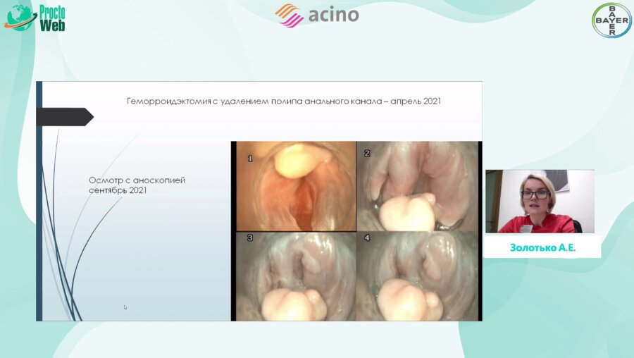 Золотько А.Е. - Клинические случаи