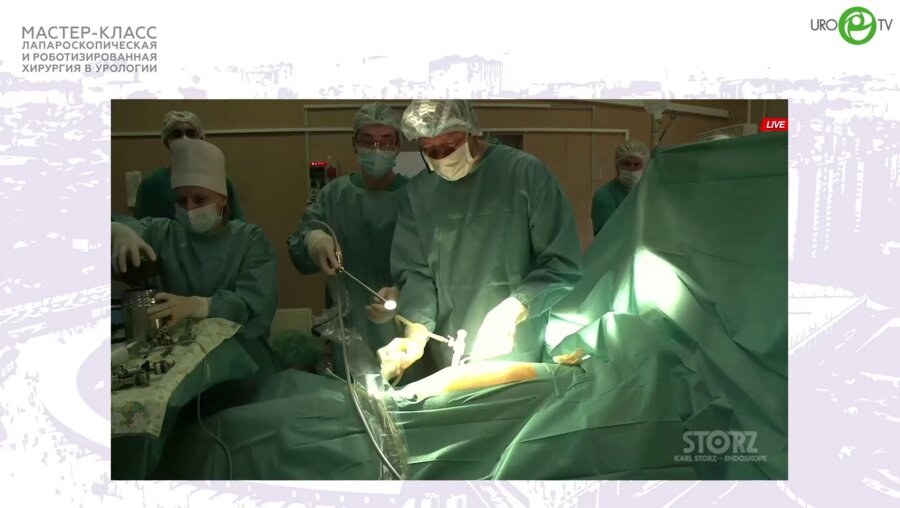 Болгов Е.Н. - Лапароскопическая пластика ЛМС