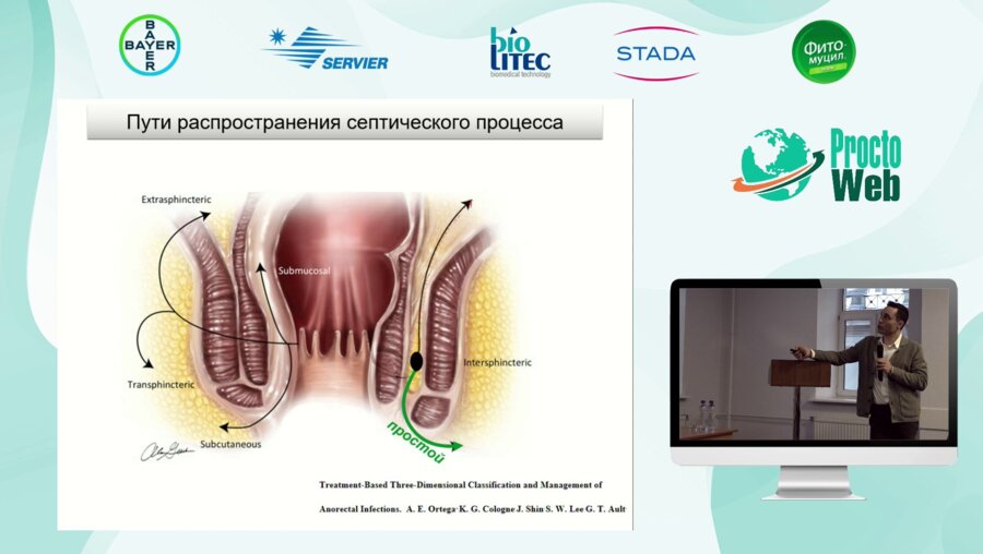 Маркарьян Д.Р. - Абсцессы и свищи прямой кишки