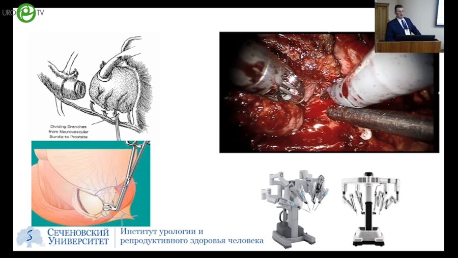 Безруков Е.А. - Радикальная простатэктомия. Стандарт и индивидуальное планирование