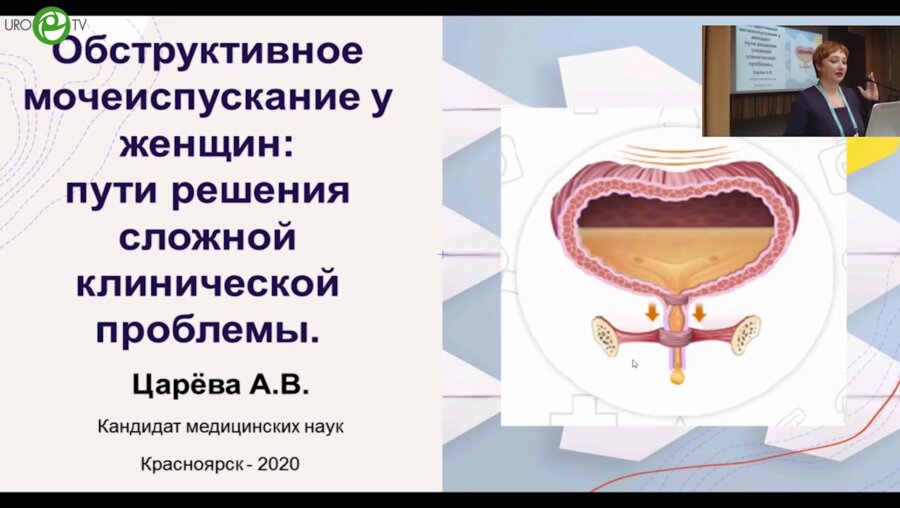 Царёва А.В. - Обструктивное мочеиспускание у женщин. Пути решения сложной клинической проблемы